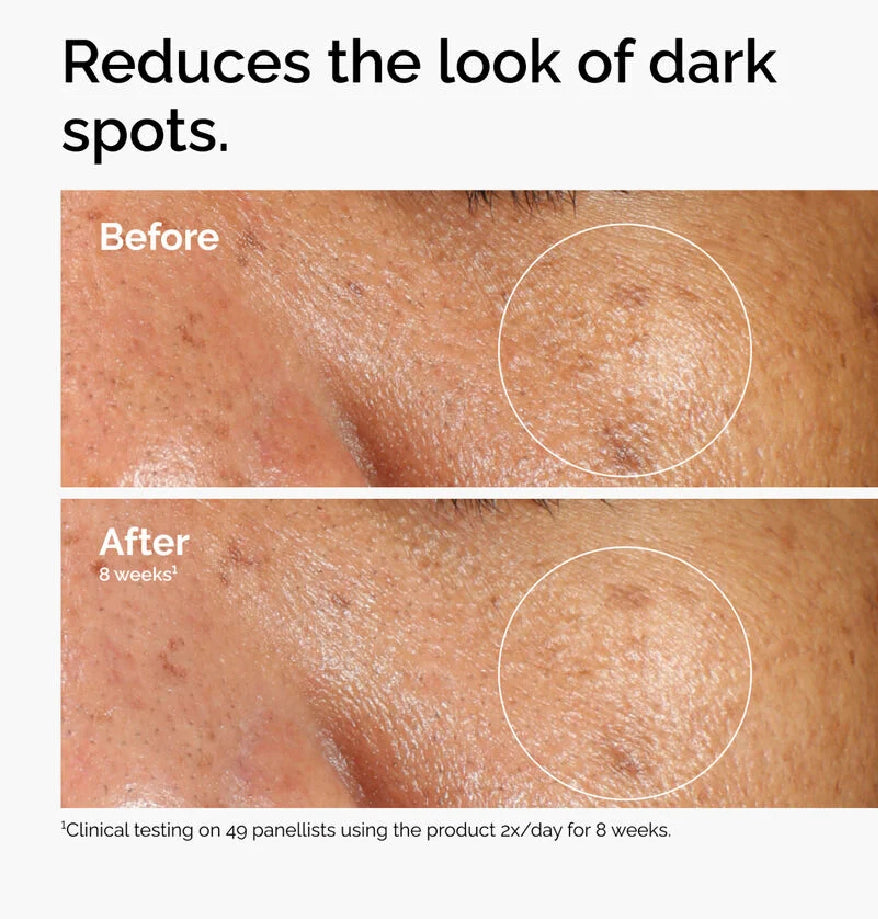 THE ORDINARY- Serum alpha arbutin 2% + HA